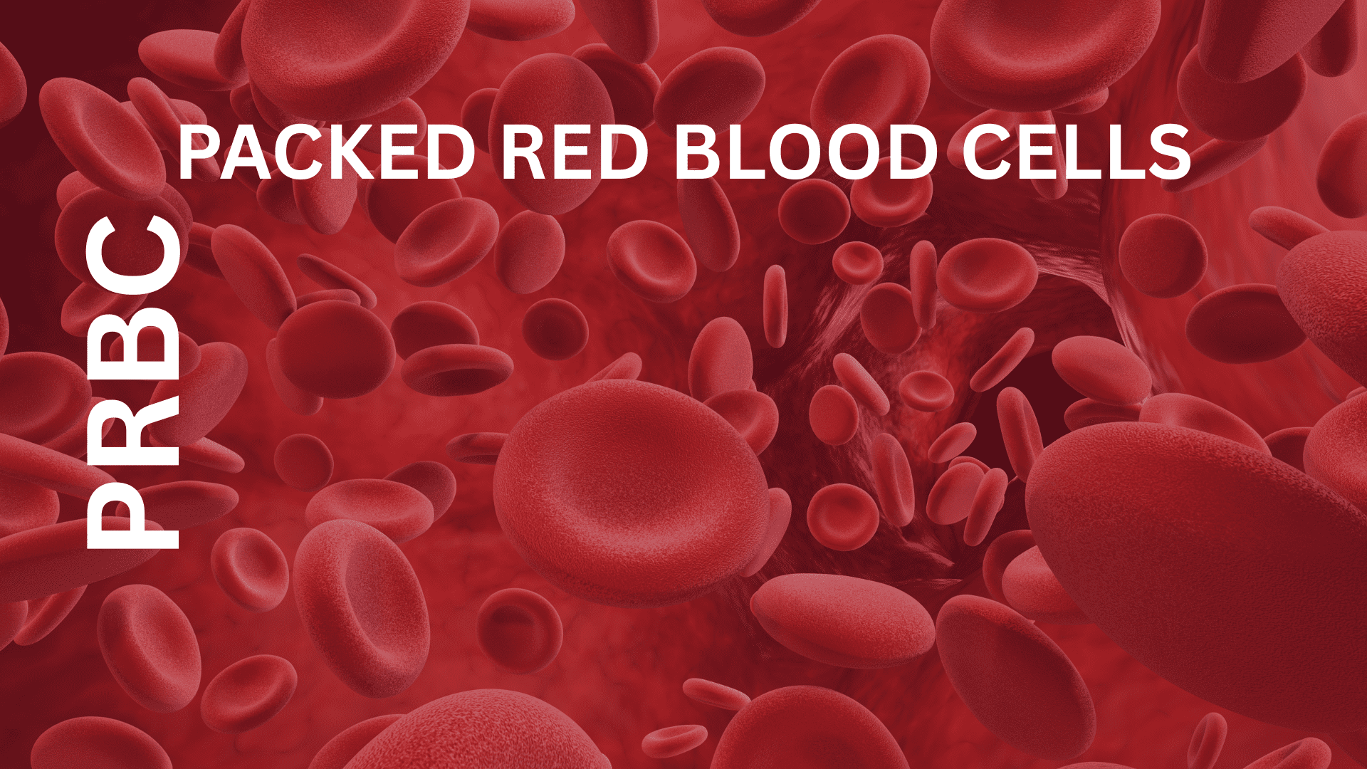 PRBC (Packed Red Blood Cells)